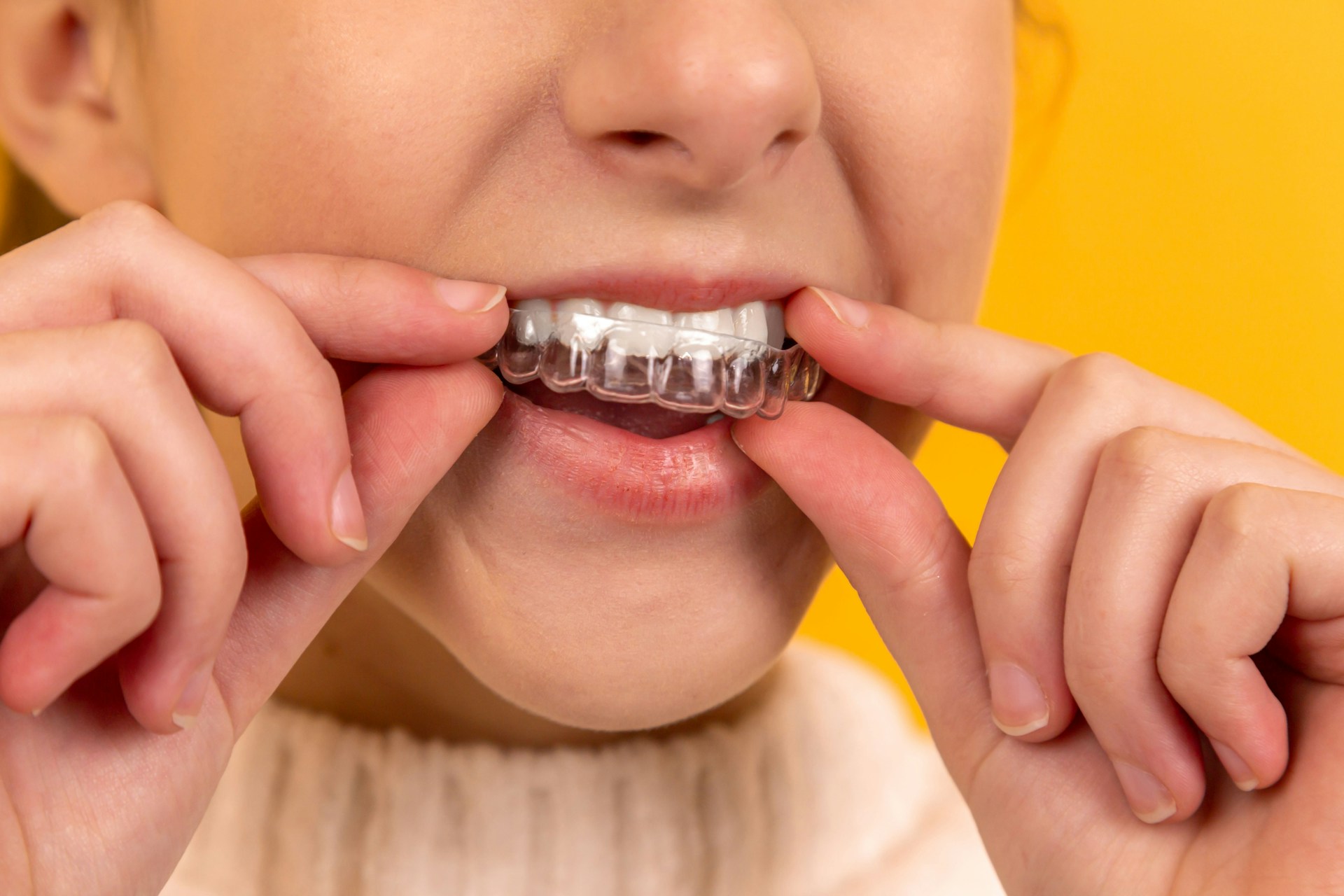 childs teeth with braces