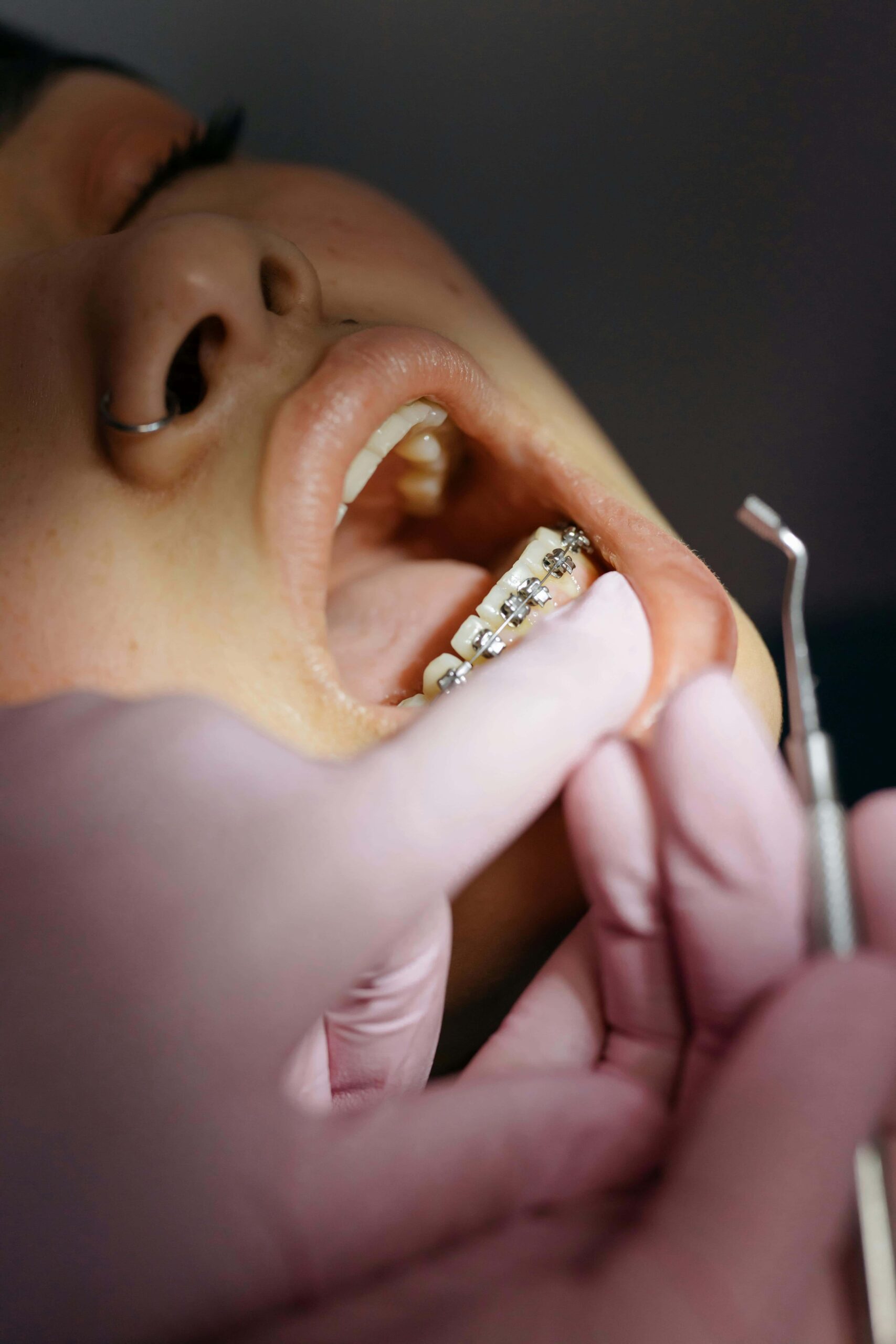 orthodontic treatment