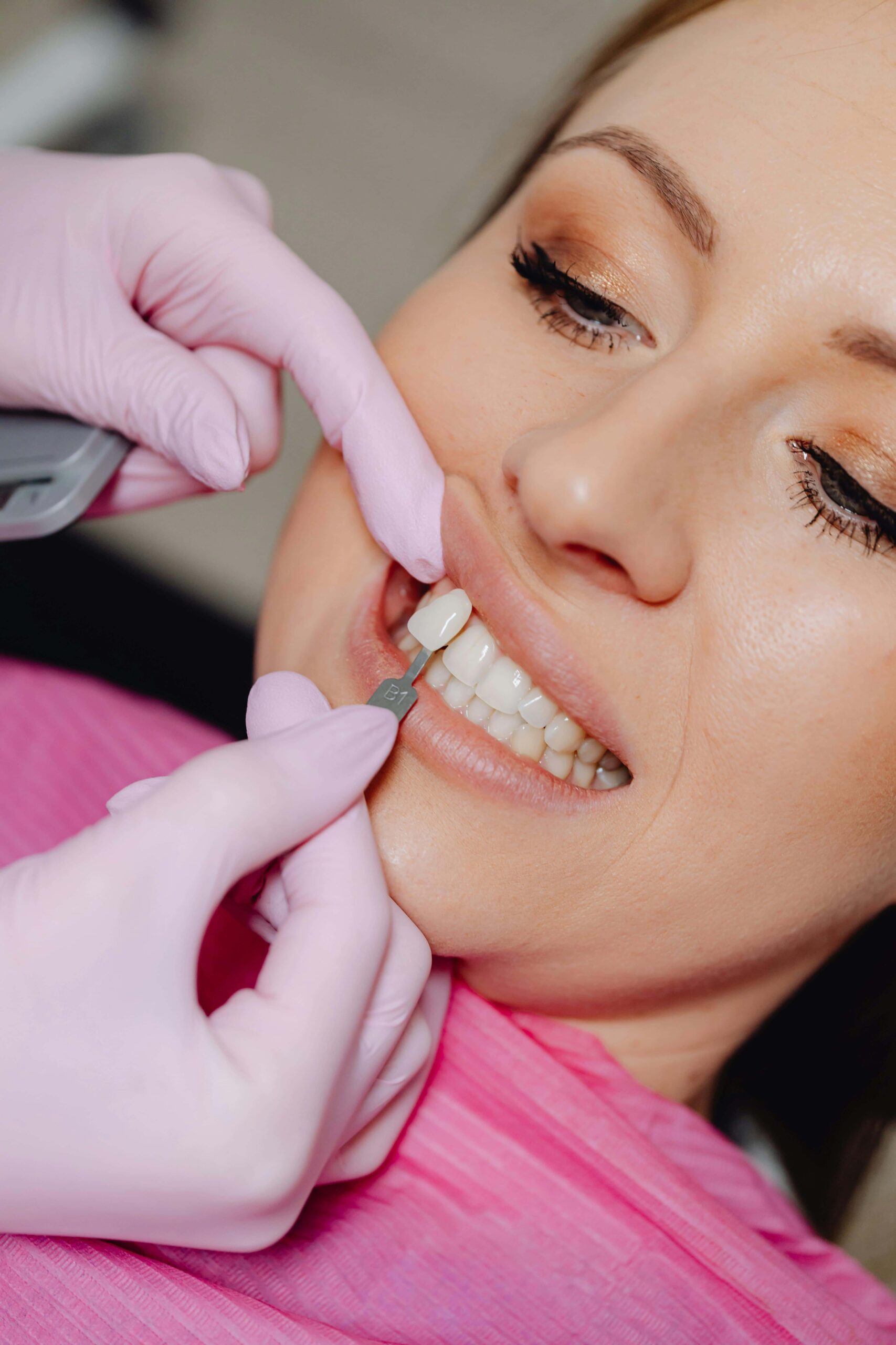 white spots on womans teeth