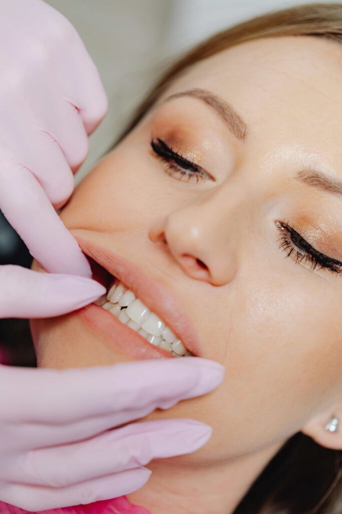 teeth after braces and retainer treatment